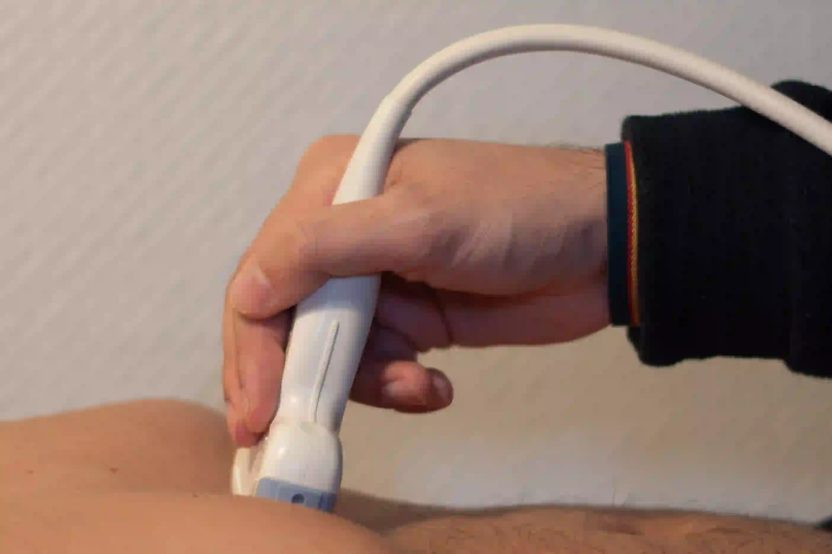 Ultraschall – Detailaufnahme des Geräts